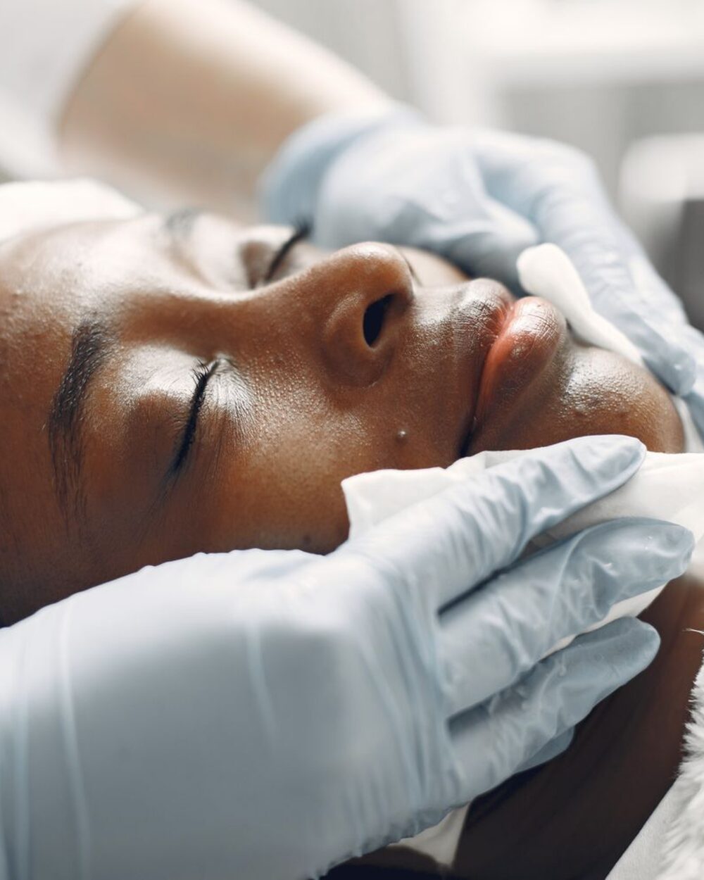 Dermal filler